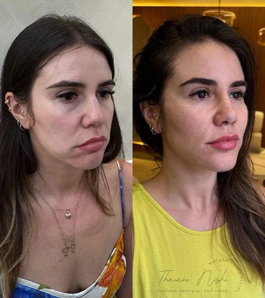 DRA THAIANI - ANTES E DEPOIS 4