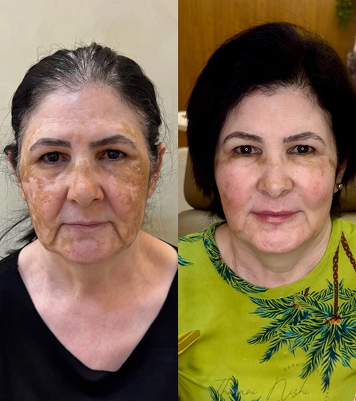 DRA THAIANI - ANTES E DEPOIS 6
