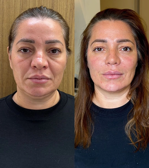 DRA THAIANI - ANTES E DEPOIS 7