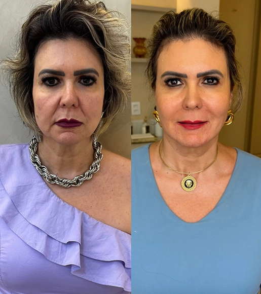 DRA THAIANI - ANTES E DEPOIS 8